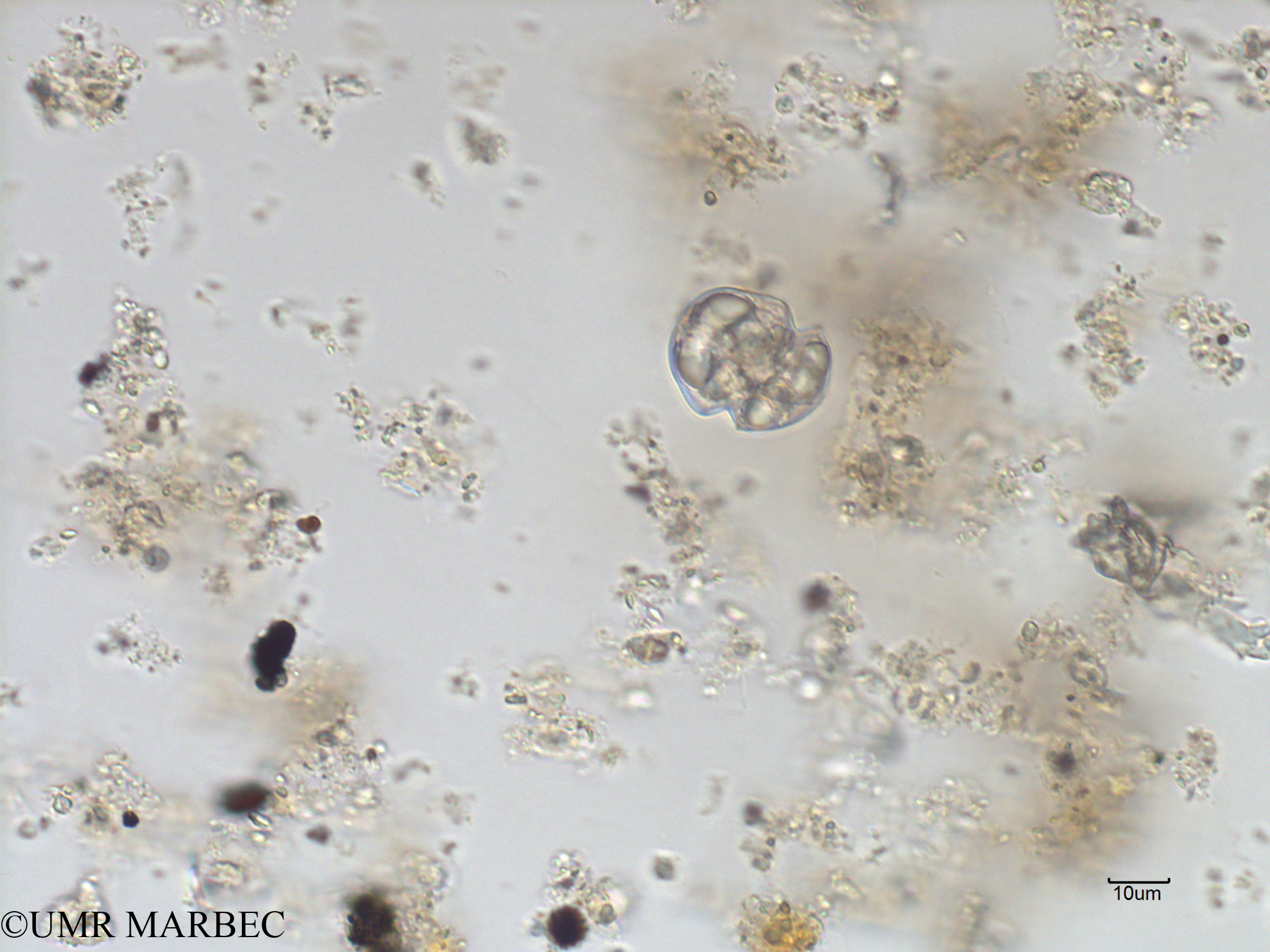 phyto/Bizerte/bizerte_bay/RISCO November 2015/Karlodinium spp (Baie_T1A-cf Karlodinium charaf-4).tif(copy).jpg